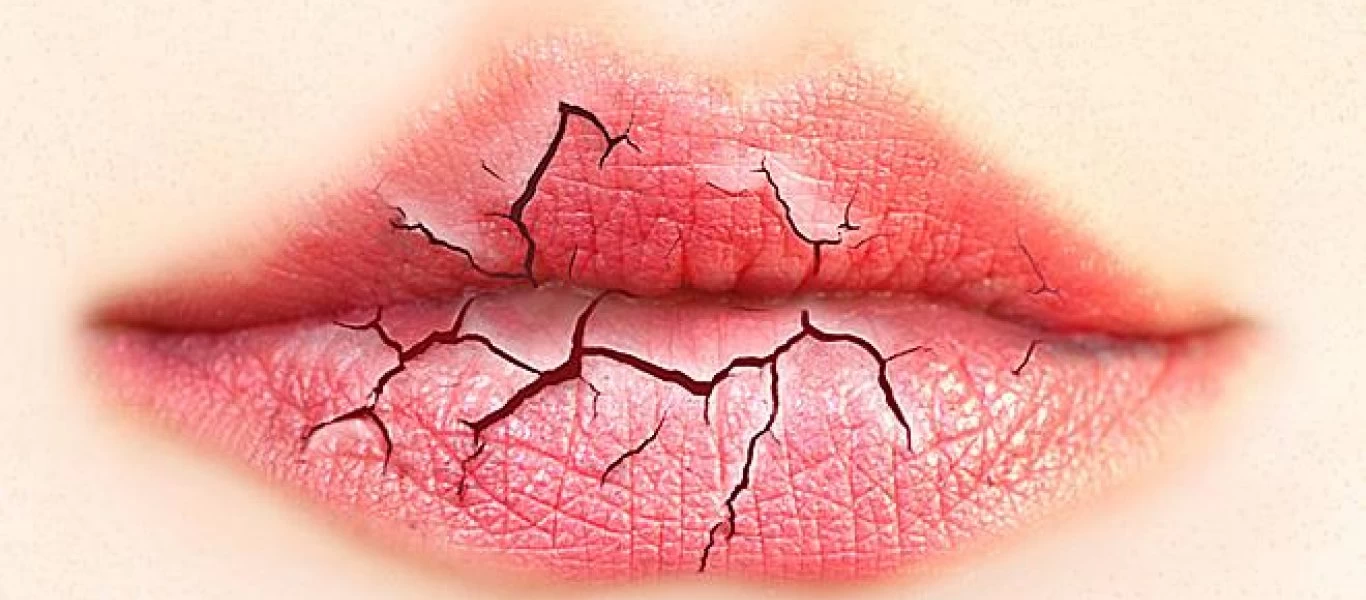 Τι παθήσεις μπορεί να κρύβει η ξηροστομία;